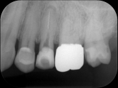 endodontology_03