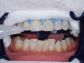 restorative_dentistry_04