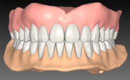 geriatric_prosthodontology_05