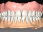 geriatric_prosthodontology_05