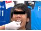 429_oral_health_sports_02