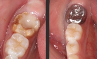 pediatric_dentistry_08
