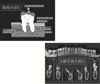TDC卒研セミナー2013　No.6　イブニングセミナー「今日からはじめる　こだわりのペリオ」〜歯根膜の臨床観察と歯周治療〜（2013年11月14日）