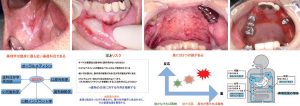 2024 TDCアカデミア 臨床セミナー／薬セミナー「知れば広がる処方の仕方」〜有病者・高齢者・妊婦・小児患者への実践的な処方〜［2024年7月7日（日）］講師：笠原正貴（東京歯科大学薬理学講座）・野村武史（東京歯科大学口腔腫瘍外科学講座）