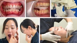 2024 TDCアカデミア 臨床セミナー／顎関節症セミナー「顎関節症の治療法をアップデート」〜 顎関節症の診断から基本治療・難症例について〜［2024年10月27日（日）］講師：島田　淳（東京都開業）