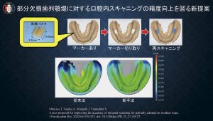 2025 TDCアカデミア 臨床セミナー／デジタルセミナー「デジタル有床義歯の現在」〜基本は同じ　デジタルワークフローがもたらす革新的なメリットとは何か〜［2025年6月1日（日）］講師：田坂　彰規（東京歯科大学パーシャルデンチャー補綴学講座）・竜　　正大（東京歯科大学老年歯科補綴学講座）・飯田　雄太（岡山県開業）・平林　　剛（東京歯科大学水道橋病院歯科技工室）