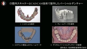 2025 TDCアカデミア 臨床セミナー／デジタルセミナー「デジタル有床義歯の現在」〜基本は同じ　デジタルワークフローがもたらす革新的なメリットとは何か〜［2025年6月1日（日）］講師：田坂　彰規（東京歯科大学パーシャルデンチャー補綴学講座）・竜　　正大（東京歯科大学老年歯科補綴学講座）・飯田　雄太（岡山県開業）・平林　　剛（東京歯科大学水道橋病院歯科技工室）