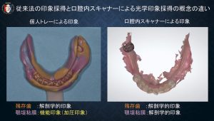 2025 TDCアカデミア 臨床セミナー／デジタルセミナー「デジタル有床義歯の現在」〜基本は同じ　デジタルワークフローがもたらす革新的なメリットとは何か〜［2025年6月1日（日）］講師：田坂　彰規（東京歯科大学パーシャルデンチャー補綴学講座）・竜　　正大（東京歯科大学老年歯科補綴学講座）・飯田　雄太（岡山県開業）・平林　　剛（東京歯科大学水道橋病院歯科技工室）