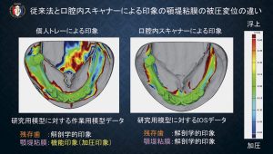 2025 TDCアカデミア 臨床セミナー／デジタルセミナー「デジタル有床義歯の現在」〜基本は同じ　デジタルワークフローがもたらす革新的なメリットとは何か〜［2025年6月1日（日）］講師：田坂　彰規（東京歯科大学パーシャルデンチャー補綴学講座）・竜　　正大（東京歯科大学老年歯科補綴学講座）・飯田　雄太（岡山県開業）・平林　　剛（東京歯科大学水道橋病院歯科技工室）