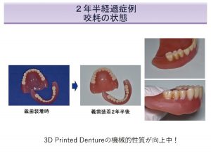 2025 TDCアカデミア 臨床セミナー／デジタルセミナー「デジタル有床義歯の現在」〜基本は同じ　デジタルワークフローがもたらす革新的なメリットとは何か〜［2025年6月1日（日）］講師：田坂　彰規（東京歯科大学パーシャルデンチャー補綴学講座）・竜　　正大（東京歯科大学老年歯科補綴学講座）・飯田　雄太（岡山県開業）・平林　　剛（東京歯科大学水道橋病院歯科技工室）