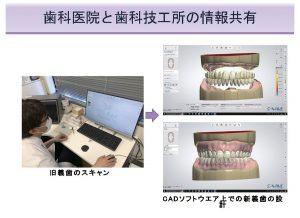 2025 TDCアカデミア 臨床セミナー／デジタルセミナー「デジタル有床義歯の現在」〜基本は同じ　デジタルワークフローがもたらす革新的なメリットとは何か〜［2025年6月1日（日）］講師：田坂　彰規（東京歯科大学パーシャルデンチャー補綴学講座）・竜　　正大（東京歯科大学老年歯科補綴学講座）・飯田　雄太（岡山県開業）・平林　　剛（東京歯科大学水道橋病院歯科技工室）