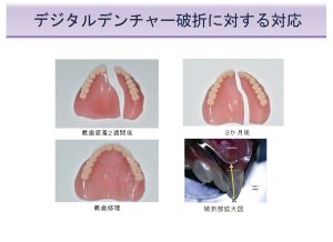 2025 TDCアカデミア 臨床セミナー／デジタルセミナー「デジタル有床義歯の現在」〜基本は同じ　デジタルワークフローがもたらす革新的なメリットとは何か〜［2025年6月1日（日）］講師：田坂　彰規（東京歯科大学パーシャルデンチャー補綴学講座）・竜　　正大（東京歯科大学老年歯科補綴学講座）・飯田　雄太（岡山県開業）・平林　　剛（東京歯科大学水道橋病院歯科技工室）