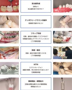 2025 TDCアカデミア 臨床セミナー／ベーシックハンズオンセミナー ２日間コース「すぐに役立つ臨床のコツ」 〜実践スキルの向上 補綴、矯正、ぺリオ、口腔外科編〜［2025年8月24日（日）・9月7日（日）全2日］