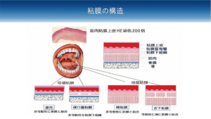 2026 TDCアカデミア 臨床セミナー／口腔外科セミナー「明日から活かせる！日常臨床における小手術の実践（VR体験）とポイント」〜確実な術式とトラブル回避のための臨床ノウハウ〜［2026年7月5日（日）、講師：渡邊　　章（口腔顎顔面外科学講座）菅原　圭亮（口腔病態外科学講座）］