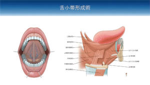2026 TDCアカデミア 臨床セミナー／口腔外科セミナー「明日から活かせる！日常臨床における小手術の実践（VR体験）とポイント」〜確実な術式とトラブル回避のための臨床ノウハウ〜［2026年7月5日（日）、講師：渡邊　　章（口腔顎顔面外科学講座）菅原　圭亮（口腔病態外科学講座）］