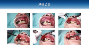 2026 TDCアカデミア 臨床セミナー／口腔外科セミナー「明日から活かせる！日常臨床における小手術の実践（VR体験）とポイント」〜確実な術式とトラブル回避のための臨床ノウハウ〜［2026年7月5日（日）、講師：渡邊　　章（口腔顎顔面外科学講座）菅原　圭亮（口腔病態外科学講座）］