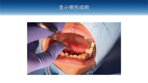 2026 TDCアカデミア 臨床セミナー／口腔外科セミナー「明日から活かせる！日常臨床における小手術の実践（VR体験）とポイント」〜確実な術式とトラブル回避のための臨床ノウハウ〜［2026年7月5日（日）、講師：渡邊　　章（口腔顎顔面外科学講座）菅原　圭亮（口腔病態外科学講座）］