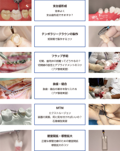 2026 TDCアカデミア 臨床セミナー／ベーシックハンズオンセミナー ２日間コース「すぐに役立つ臨床のコツ」〜実践スキルの向上　補綴、ペリオ、エンド、口腔外科、矯正編〜［2026年8月30日（日）・9月6日（日）全2日］