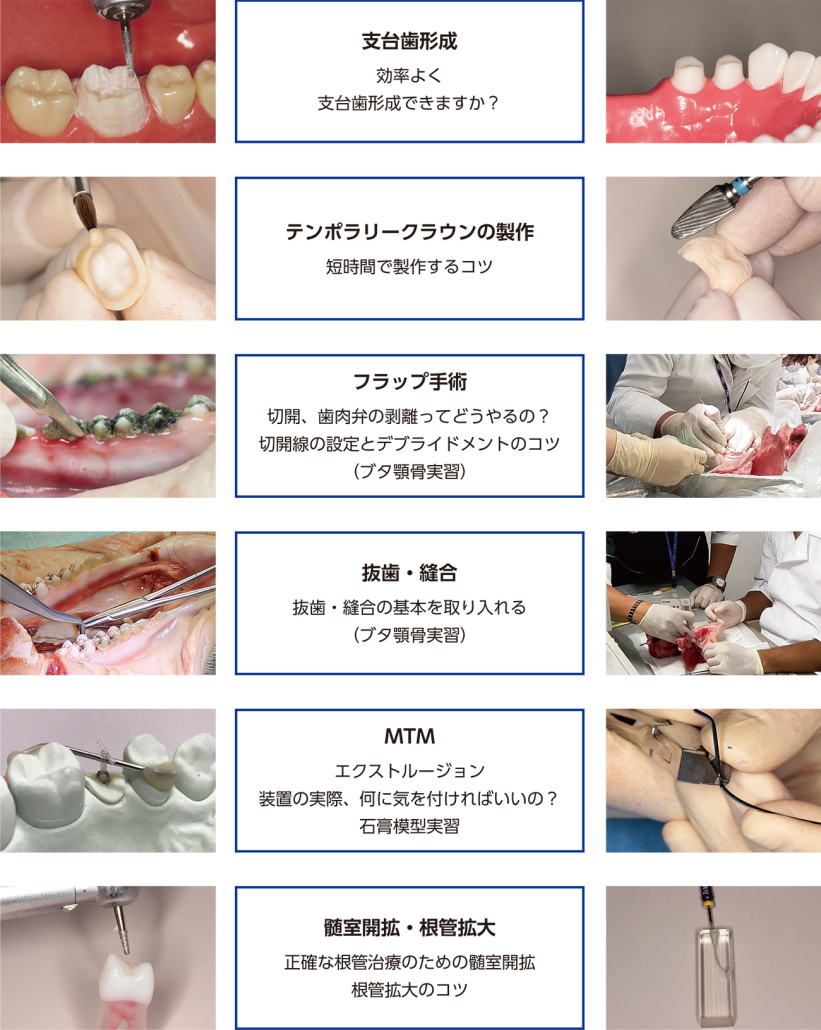 2026 TDCアカデミア 臨床セミナー　ベーシックハンズオンセミナー ２日間コース「すぐに役立つ臨床のコツ」 〜実践スキルの向上　補綴、ペリオ、エンド、口腔外科、矯正編〜［2026年8月30日（日）・9月6日（日）全2日］
